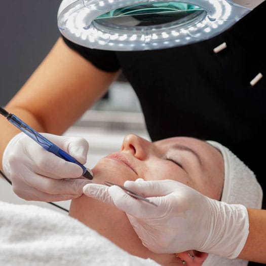 Vrouw gebruikt elektrisch apparaat voor gezichtshaarverwijdering voor een gladde huid.