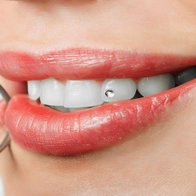 Close-up van een glimlach met een tandkristal juweel op een tand.