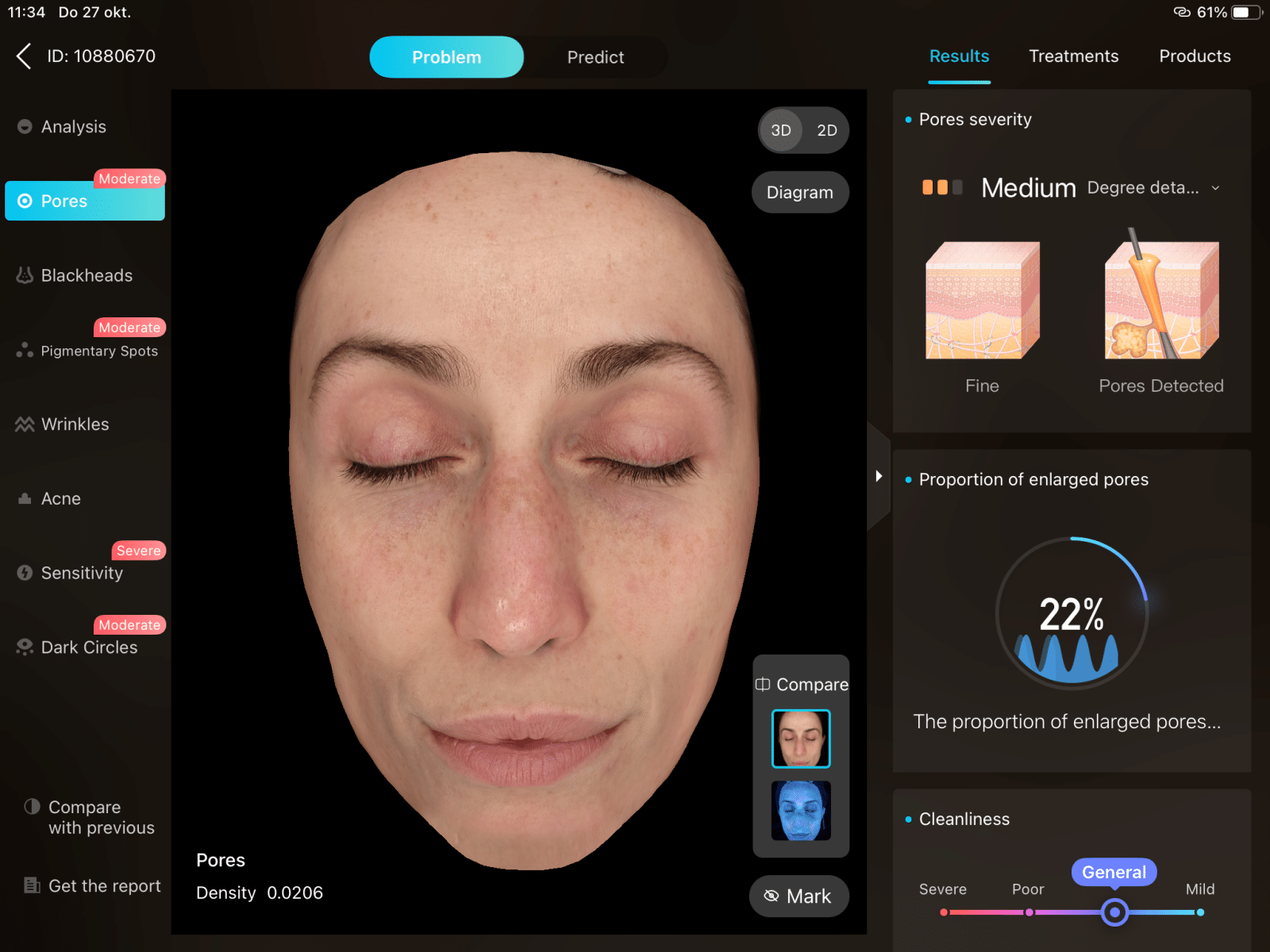 Resultaten gezichtsscan met huidanalyse en -conditie.